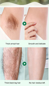 Épilation Mousse Crème Hommes Femmes À Base De Plantes OEM Bras Aisselle Épilation <span class=keywords><strong>Spray</strong></span> Fabriqué Professionnel Crème <span class=keywords><strong>Dépilatoire</strong></span> - Product Image 6