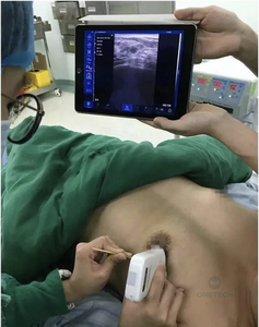 C37A Portable 128 Elemento Inalámbrico vascular USG Ultrasonido Sonda de ultrasonido lineal - Product Image 3