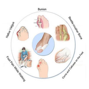 Sollievo dal dolore borsite dolore separator, medico <span class=keywords><strong>del</strong></span> silicone <span class=keywords><strong>del</strong></span> silicone pedicure di protezione della punta di silicone elastico borsite corrector stecca - Product Image 5