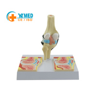 Modèle d'arthrite rhumatoïde du genou grandeur nature pour l'orthopédie humaine, vente en gros d'usine, science médicale, anatomie humaine