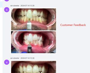 Expédition immédiate Meilleur résultat blanchissant Gel blanchissant pour les dents à 44% de peroxyde d'hydrogène 4:1 en seringue à double canon - Product Image 6