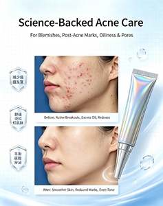 Crema <span class=keywords><strong>Viso</strong></span> OEM Rapida ed Efficace con Acido Salicilico ed Estratto di Centella Asiatica per Cicatrici da Brufoli, Rimozione Macchie, Gel Anti-Acne per una Pelle Liscia - Product Image 1