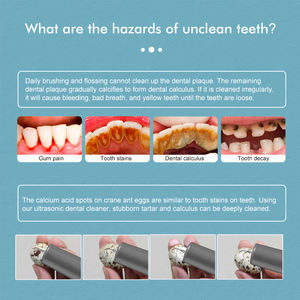 Elektrische Ultrasone Tanden Reiniger Tandheelkundige Calculus Vlekkenverwijderaar Effectieve Orale Tandplak Tandsteen <span class=keywords><strong>Scaler</strong></span> Thuisgebruik Tanden - Product Image 3