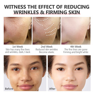 <span class=keywords><strong>VOVA</strong></span> Retinol Suero Facial 30ml Antienvejecimiento Iluminador Antiarrugas 30ml - Product Image 2