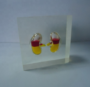 Özel sıvı tıbbi hediye akrilik akciğer kağıt ağırlığı - Product Image 1