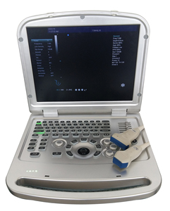 Sondas Convexas y Lineales, Escáner de Ultrasonido Doppler a Color para Laptop, Ultrasonido Veterinario, Máquina de Ultrasonido Portátil - Product Image 5