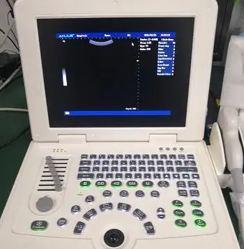 China Goedkoopste Medische Draagbare Volledige Digitale Kleur Doppler B Ultrasound Scanner/Scan/Machine Prijs Voor Zwangerschap Met Probe