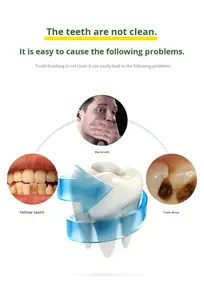 Cepillo de Dientes Sónico con Cabezal de Silicona en Forma de U, 360 Grados, Inteligente, Automático, Carga USB, Impermeable, Blanqueador Dental, Venta al Por Mayor - Product Image 5