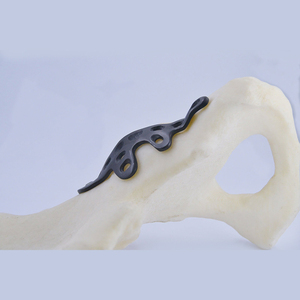 Servicio de Impresión 3D de Metal Médico Personalizado con Acero Inoxidable, Aluminio y Titanio |   Tecnología SLM |   Soluciones OEM - Product Image 4
