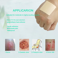 Pansement en silicone stérile absorbant Dimora rose/bleu, pansement adhésif en mousse imperméable, consommables médicaux CE