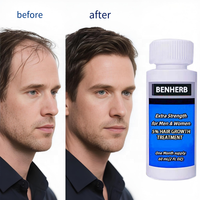 Sérum capillaire concentré réparateur et nourrissant 6-en-1 OEM Kirland Herbal Biotin Bio anti-pelliculaire 60 ml
