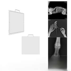 Detector de Panel Plano de Rayos X Delgado y Ligero de 14x17, Panel DR de Rayos X Digital para Imágenes Médicas y Uso Veterinario - Product Image 3