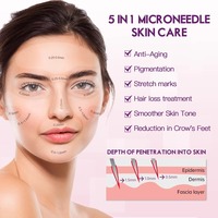 Kit de dermaroller 5 en 1 pour le soin de la peau, 5 têtes remplaçables