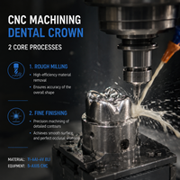 Usinage CNC 5 axes + tournage pour la réparation personnalisée des dents endommagées ou manquantes afin de restaurer la fonction d'occlusion