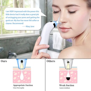 Removedor de Puntos Negros Eléctrico Recargable para Uso Doméstico, Limpieza Facial, Eliminación de Acné y Espinillas, Limpiador de Poros - Product Image 3