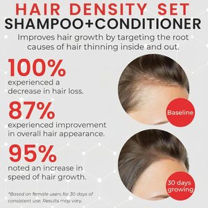Champú y Acondicionador Activador de Folículos de Grado Clínico, Detiene la Caída del Cabello, Promueve el Crecimiento Visible, Cuidado del Cuero Cabelludo <span class=keywords><strong>con</strong></span> Tecnología Patentada Avanzada - Product Image 5