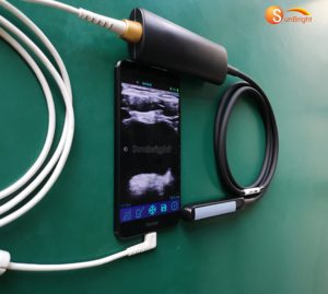 Portable <span class=keywords><strong>Echographe</strong></span> USB Usg Wifi SUN-R1 Instrument Vétérinaire Vache <span class=keywords><strong>Bovin</strong></span> Equine Grossesse USB Sonde Linéaire Rectale Ecografo - Product Image 3