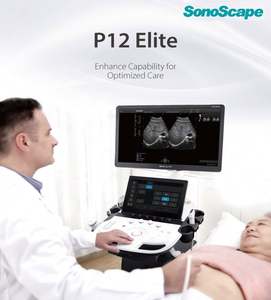 Appareil d'échographie Doppler couleur 4D Sonoscape P12Elite avec grand écran pour l'obstétrique / la cardiologie / l'abdomen - Product Image 2