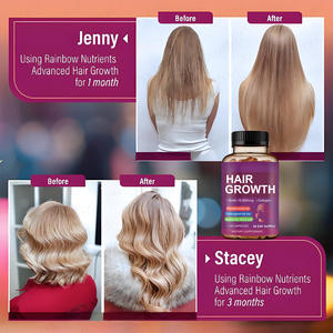 <span class=keywords><strong>Suplemento</strong></span> Synkonda <span class=keywords><strong>para</strong></span> <span class=keywords><strong>el</strong></span> Crecimiento del Cabello con Biotina 10000mcg y Colágeno, 120 Cápsulas, Nutre <span class=keywords><strong>el</strong></span> Cabello con Vitaminas, <span class=keywords><strong>Zinc</strong></span> y MSM, Belleza Natural <span class=keywords><strong>para</strong></span> Mujeres Adultas - Product Image 4