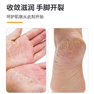 Cinta adhesiva transpirable, de alta adherencia, envasada individualmente, resistente a las grietas, para otoño e invierno, antiabrasión. - Product Image 2