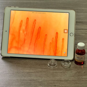 Analyseur de microcirculation sanguine <span class=keywords><strong>Microscope</strong></span> biologique médical 400x pour clinique - Product Image 4