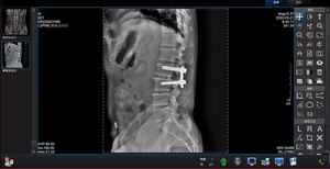 أجهزة الأشعة السينية الطبية، جهاز أشعة سينية رقمي محمول، جهاز أشعة سينية متنقل - Product Image 6