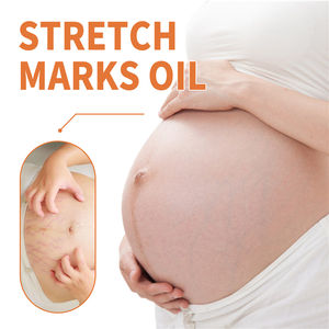 OEM Doğal Bitki Özlü Çatlak İzi Onarıcı Yağ, Hamilelik Cilt Bakımı, Yara İzi Yatıştırıcı ve Nemlendirici Destek 100ml - Product Image 3