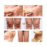 Crème Éclaircissante Puissante Anti-Taches en 7 Jours – Correcteur de Taches Brunes – Soin Visage et Corps – Marque Privée