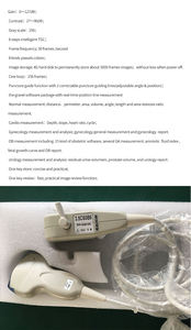 Échographe vétérinaire portable à sonde linéaire pour usage humain - Product Image 3