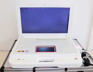 Sistema de Cámara Endoscópica Médica Quirúrgica Portátil 2024 para Laparoscopia, Artroscopia y Cirugía ENT - Product Image 3