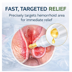 Gel <span class=keywords><strong>para</strong></span> Hemorroides de Grado Médico Clase II, Carbómero, Aplicador <span class=keywords><strong>para</strong></span> Tratamiento Anal, Alivio de Hemorroides Externas, Dolor, Picazón, Hinchazón de la Piel - Product Image 5