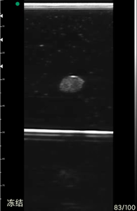 Modèle de mannequin d'échographie grandeur nature pour l'enseignement et la formation à la ponction de tumeur mammaire guidée par échographie, avec matériau PVC avancé - Product Image 5