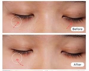 Nuevo Tubo Láser de CO2 de Alta Calidad, Máquina de Láser Fraccional de CO2, Máquinas de Grabado Láser Portátiles de CO2 - Product Image 6
