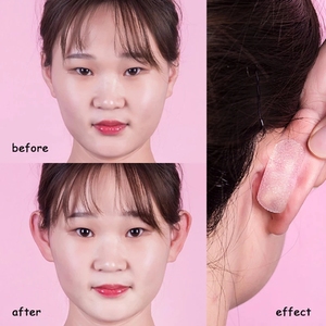 Dụng Cụ Chỉnh Tai Vô Hình Miếng Dán Dọc Điều Chỉnh Tai Veneer Elf Bền Bỉ Dụng Cụ Định Hình Tai Chuyên Nghiệp Dễ Mang Theo - Product Image 5