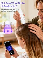 Analyseur de cuir chevelu HD portable avec zoom 50x-200x, WiFi + USB-C, détecteur de follicules pileux et de peau avec lumière UV, analyse du cuir chevelu