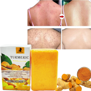 Tùy chỉnh tự nhiên hữu cơ tốt nhất nghệ mặt rửa da làm trắng thanh Xà phòng thanh toán bù trừ nhược điểm sáng nghệ xà phòng - Product Image 5