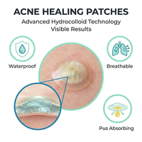 Patchs Hydrocolloïdes Invisibles pour l'Acné – Soin du Visage, Couvre-Boutons, Marque Privée – Réduit les Rougeurs, Traitement Anti-Acné