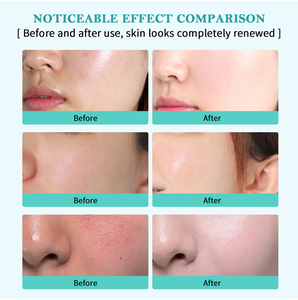Crème pour le visage PDRN avec acide hyaluronique, hydratante, réparatrice, anti-âge, raffermissante pour peaux sèches, soins de la <span class=keywords><strong>peau</strong></span> OEM ODM - Product Image 6