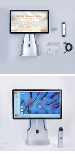 Analizador de Cuero Cabelludo con IA S1, Versión Inalámbrica, Cuerpo Metálico, Conexión USB, Máquina Multifuncional para Análisis de Piel - Product Image 6