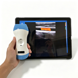 Escáner de Ultrasonido Inalámbrico Portátil Sin Cables para Servicio de Clínica Móvil, Descarga y Almacenamiento de Informes de Exámenes de Pacientes - Product Image 5
