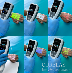 Pet Humano Médico Veia <span class=keywords><strong>Finder</strong></span> Scanner Infravermelho Portátil Clínica Use Veia <span class=keywords><strong>Finder</strong></span> Máquina - Product Image 4