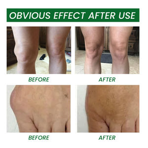 EELHOE Gel articulaire et osseux apaisant 30 ml, arthrite, kystes, œdème, réparation des tissus articulaires, gel articulaire osseux à appliquer en roll-on - Product Image 5