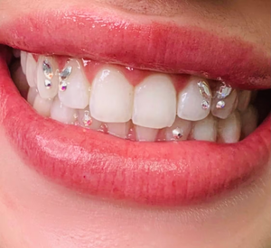 Oferta Especial: Gemas Dentales de Mariposa Sin Plomo, Piedras de Cristal de Varios Colores y Formas, Kit de Joyería Multiusos para Higiene Bucal - Product Image 4
