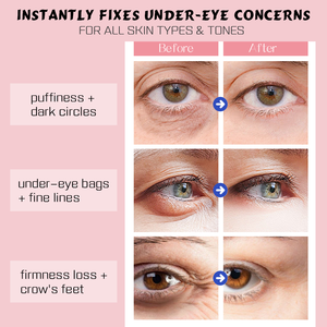 Private Label Dark Circle Wrinkle Reducing Eye <strong>Cream</strong> Set for Fine Lines and Brightening for Dryness Eye - Product Image 4