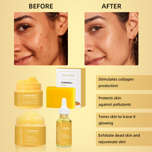 <span class=keywords><strong>Meilleur</strong></span> kit de soin du <span class=keywords><strong>visage</strong></span> à base de plantes hydratant à la vitamine C éclaircissant réparateur blanchissant <span class=keywords><strong>anti</strong></span>-<span class=keywords><strong>âge</strong></span> <span class=keywords><strong>anti</strong></span>-acné au curcuma - Product Image 5