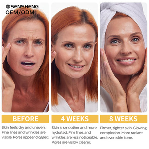 <span class=keywords><strong>Crema</strong></span> <span class=keywords><strong>Viso</strong></span> Notte Antirughe e Rassodante Naturale Coreana con Astaxantina, Etichetta Privata, Stampa Dorata per Donne, Adatta a Tutti i Tipi di Pelle - Product Image 4