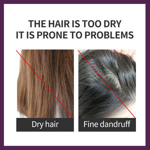 Champú Sedoso Greenlem con Aceite de Argán, Limpia e Hidrata, Elimina la <span class=keywords><strong>Caspa</strong></span> - Product Image 3