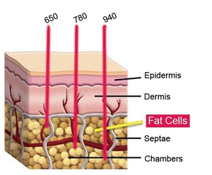 Nhật Bản Mitsubishi điốt lipolaser 5D quyền lực mạnh mẽ 28D Lipo <span class=keywords><strong>laser</strong></span> giảm béo nhanh máy ánh sáng màu đỏ miếng đệm đốt cháy chất béo hình dạng cơ thể - Product Image 6