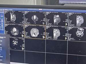 Scanner IRM mobile réutilisable EUR VET pour animaux de compagnie, usage chirurgical orthopédique, diagnostic, équipement médical - Product Image 4