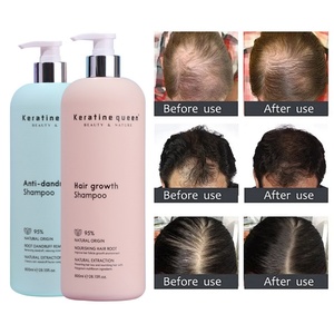 High Quality Organic Product Anti-dandruff Oil Control Fluffy <b>Shampoo</b> Silicone Free Fluffy <b>Shampoo</b> Daily-Use - Product Image 1